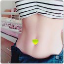 시서스 다이어트 후기+ 알약 도움으로 10kg 감량 성공