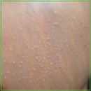 미엔느의원 | 민감한 피부 세심한 선택이 필요한 순간