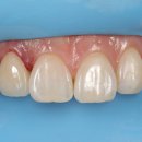 네츄럴치과기공소 이미지