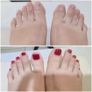 7423 | 대전무좀발톱연장 전문 뮬랑네일 페디큐어 후기