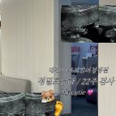미즈제일여성병원 | [임신기록 8] 대전 미즈제일여성병원 정밀초음파 후기 👶🏻 / 임신 20~ 24주차 검사