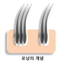 모션의원 이미지