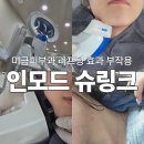 미금약국 | 미금역피부과 이중턱살 제거 인모드 fx와 슈링크 리프팅 후기 효과 부작용 통증 멍