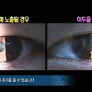 선글라스 유효기간.jpg 이미지