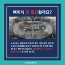 바른이유치과의원 네이버블로그