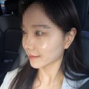 브이독 (V-dog) | 대구 범어동 윤곽관리, 무너진 얼굴라인 잡아준 범어동 핫탄스파 후기 (예신관리 추천)