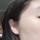 연세보드미의원 네이버블로그