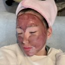 네오한의원 | [내돈내산] 성인여드름관리 압구정피부과 ㄹㅇㅋㅇ추천 골드PTT 솔직후기