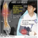 손흥민 결장 무리뉴 반응 토트넘 첼시 중계 및 EPL 슌위 관심-손승민 부상 &amp; 회복기간 예상, 팔 골절 수술 한국에서 이미지