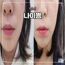 천안 불당동 윤곽관리 전문 재방문 많은 나이쁨 작은얼굴관리 추천