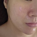 코코에스테틱 | 신중동역 피부관리 코코스킨앤바디 부천본점 트러블 진정관리 후기(4번째 방문)