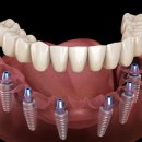 한성길치과의원 이미지