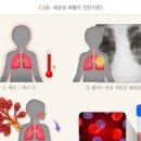 폐렴 증상 원인 합병증 치료 방법 예방백신 폐렴 치료기간 종류 이미지