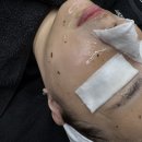 [대전 피부관리] 봉명동 피부관리 웨딩관리 건조한 날씨에 수분가득 꼼에스테틱 더마수분관리 후기