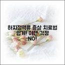 하지정맥류의 치료와 예방 | 하지정맥류 증상과 치료법, 누구나 쉽게 알아보자