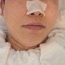 [천안 백석동 피부관리] 이정희스킨케어, 짜지지 않는 턱·목 왕여드름 맞춤 케어 솔직 후기!
