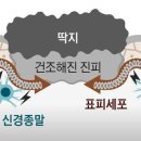 상처가 아물 때면 가려움이 느껴진다. 왜 그럴까? 이미지