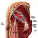 라룬 리픽스 클리닉(La Lune ReFix Clinique) | 이상근 증후군(Piriformis syndrome) 이야기 /요통/허리통증/신경통/저림/쑤심/