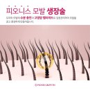 &#34;탈모탈출&#34; 두피생장술을 아시나요?? 피오니스생장술!!!!