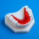 해제치과의원 | 모란역 치과 치아교정 후 유지장치가 왜 중요할까? 고정식과 가철식의 차이 비교와 관리 방법