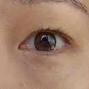 아이씨유비전케어 이미지