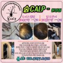 숲칼프두피클리닉탈모두피케어전문 이미지