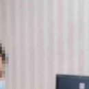 절골3 | 매부리코성형 실패 줄이려면 절골 각도와 연골 선택부터 보세요