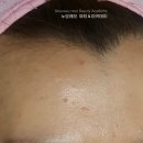 가람헤어라인