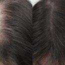 그로우모모 두피 탈모 케어센터 이미지