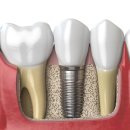 힘찬플란트치과의원 이미지