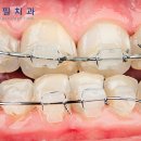 연세필치과교정과 이미지