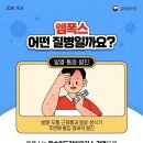 오늘의 생활 팁 - 갑작스러운 고열과 발진, 엠폭스 주의 이미지