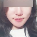 에스탑성형피부 네이버블로그