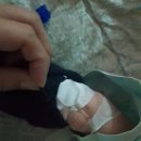 어마어마 했던 돌발진 후기(입원+퇴원)