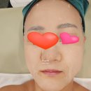 에센스 메디칼㈜ | 모공디톡스관리 올가드림뷰티 분당무지개마을점