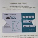 순조 | 렌즈 삽입술 7개월차 후기... 순조로울 줄 알았는데😂