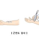 근전도 검사[electromyography] 이미지