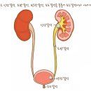 요로결석 (신장결석, 요관결석, 방광결석, 요도결석)의 정의와 증상 &amp; 체외충격파쇄석술과 요관내시경...