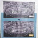 도봉안심치과의원 | 망월사역충치치료, 꼼꼼한 치과를 찾고있다면