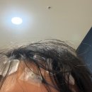 광PC방 | 기면증 수면다원 검사 및 주간수면검사 후기 (feat. 실비보험 청구)