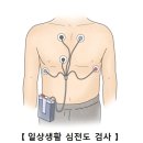 심방 세동Atrial fibrillation순환기질환 이미지