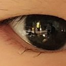 서초준안과의원 이미지