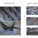 아나젠 | [고객후기] 두피/탈모케어 전문점 닥터스(양산점) 방문기 #1