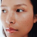 도O한의원 | 색소치료 후기｜기미·잡티·흑자, 한 가지 시술보다 중요한 것은 맞춤 패키지 치료입니다.