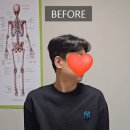 정체원 - 강남구 논현로85길 58 | 천안 아산교정 "윤쌤의 정체원" 후기