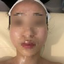 원흥 정재윤테라피 - 윤곽관리 일주일 지난 후기 재방문율 높은 원흥 피부관리