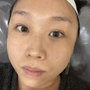 미유에스테틱 | 대전 에스테틱 프롬미유 리베룩 스킨부스터 톤업 피부관리 후기