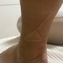 본본정형외과의원 | [임신29주+2] 정기검진일 / 임신 후기 증상 / 임산부 중족골 골절 / 아이폰으로 아기 심장소리 듣기