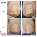 레푸스이천