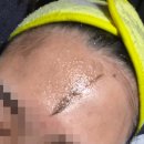 솔레인스킨케어 | 백석피부관리 추천! 솔에스테틱 스킨플래닝 솔직후기 :솔에스테틱 일산점